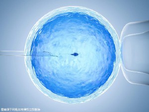 無精症